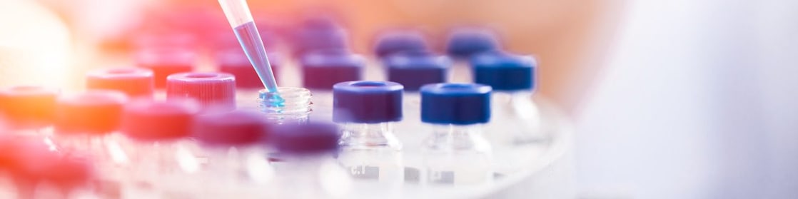 Liquid being poured into a plastic funnel by a shell scientist in a laboratory